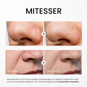 Rice Peel Glow Serum