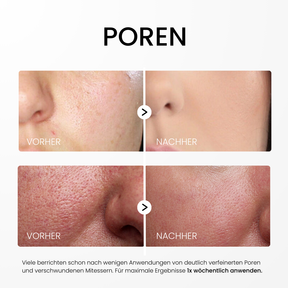 Rice Peel Glow Serum